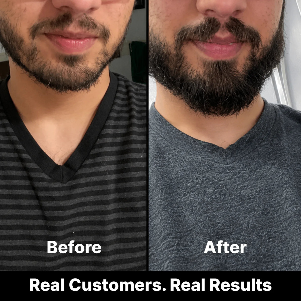 Before and after image of a customer's beard after using Weatherbeard Supply Co's Beard Growth Stimulator Oil