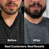 Before and after image of a customer's beard after using Weatherbeard Supply Co's Beard Growth Stimulator Oil